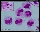 Neisseria gonorrhoeae microscopy